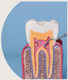 Illustration parti parodontie des traitements : coupe d'une dent pour explication avec circulation sanguine et autres détails de la dent