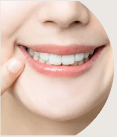 Illustration parti esthétique des traitements : sourire d'une femme