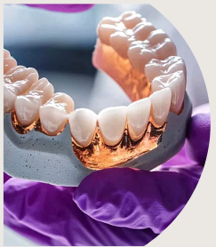 Illustration parti prothèse des traitements : machoire factice basse avec implants dans une main gantée